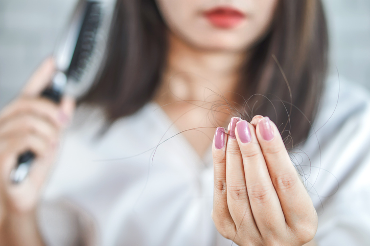 prevenir la alopecia