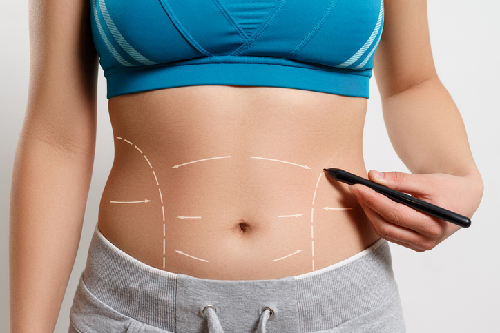La forma más sencilla de poder recuperar la figura